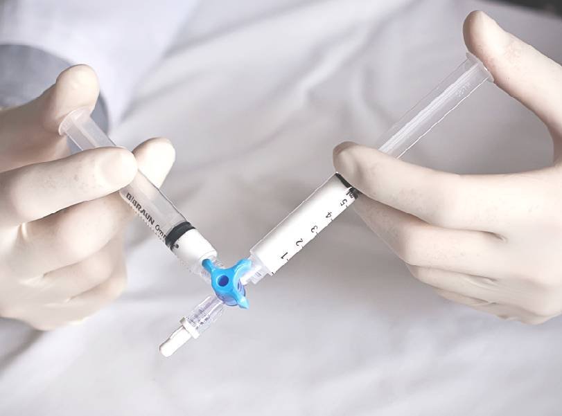 Procedimento vascular com espuma densa